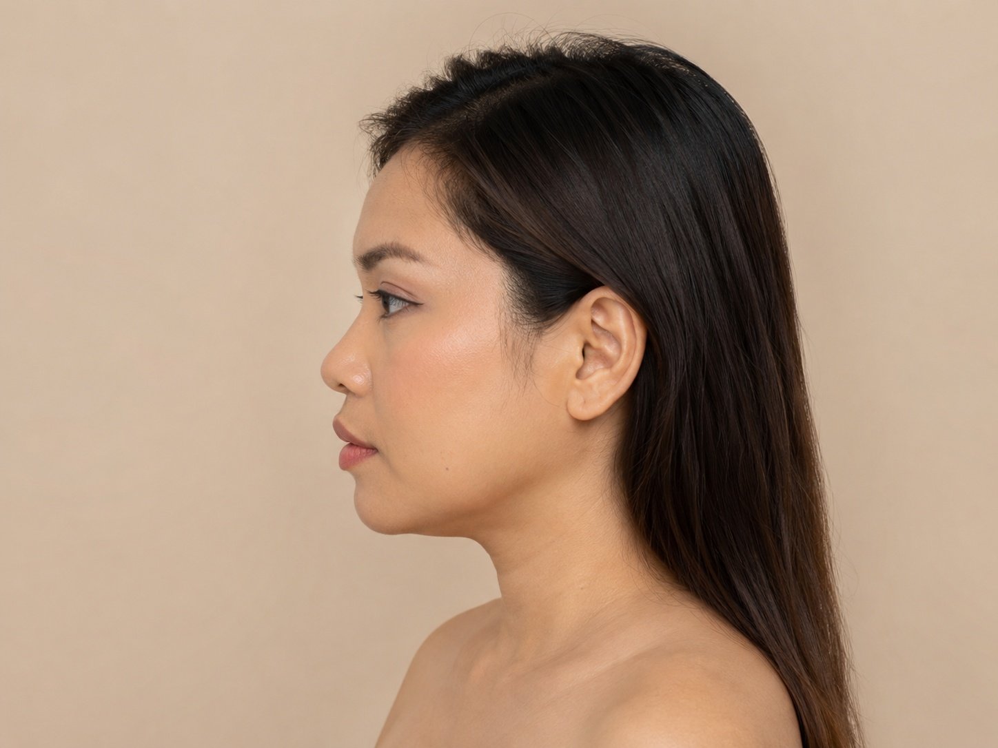 Before nose threads treatment concern